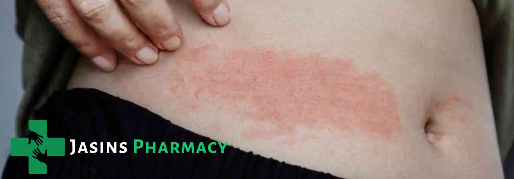 Shingles vaccine in the UK