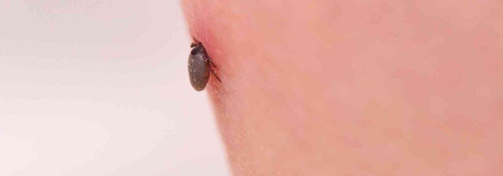 tick on person's skin