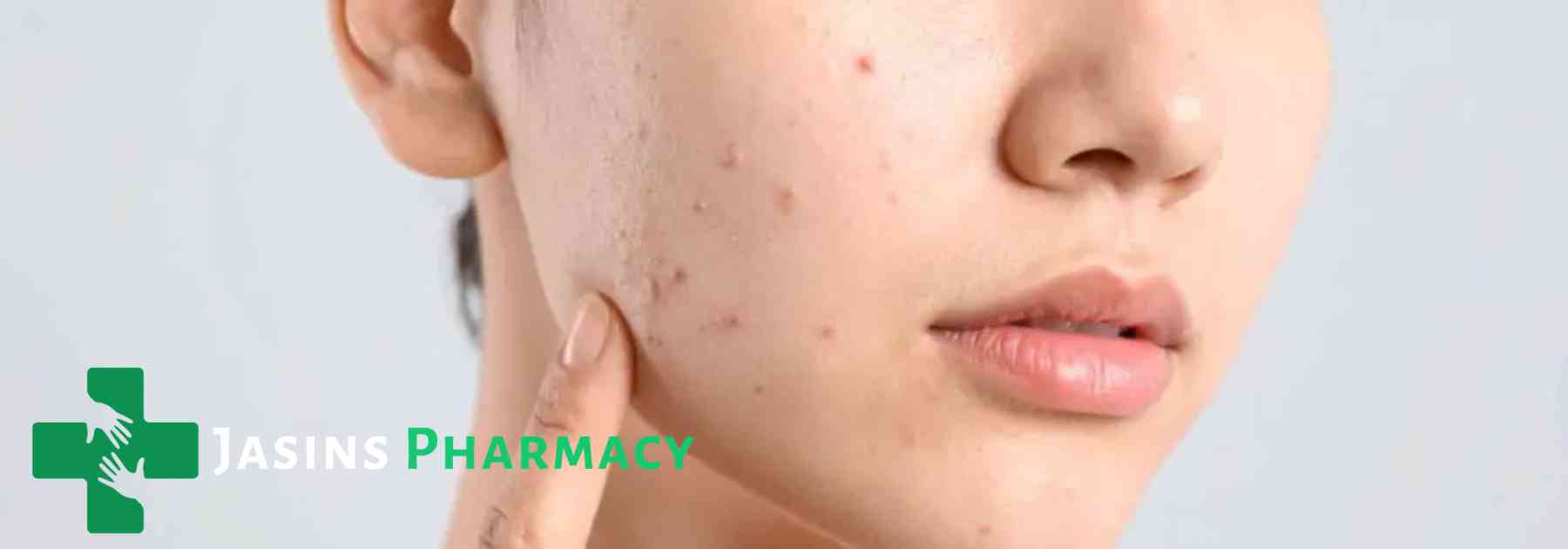 woman pointing to rash on her face