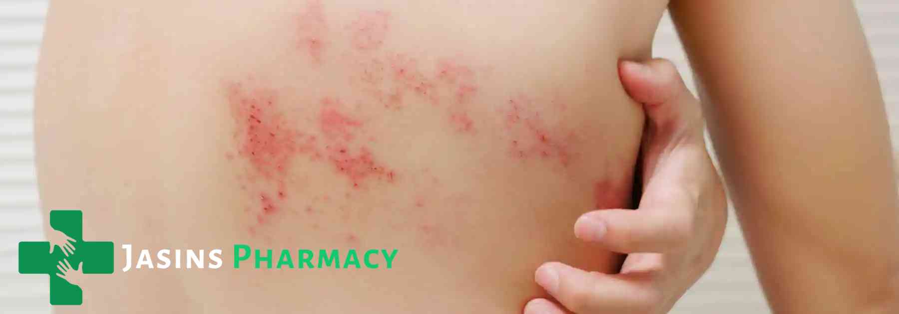 person scratching shingles rash on their back